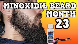 Minoxidil Beard Growth Results  Month 23  TheJourneyContinues [upl. by Beata]