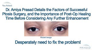 Elevating the Uneven Eyelid Correcting Asymmetry and Other Factors of Successful Ptosis Surgery [upl. by Aneg207]