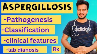 Aspergillosis microbiologymorphologypathogenesislabdiagnosisTreatment [upl. by Rolanda341]