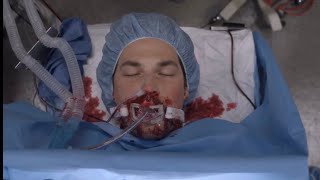 DeLuca Dies  Greys Anatomy Season 17 Episode 7 [upl. by Euqinom]