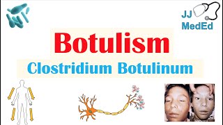 Botulism Clostridium Botulinum Pathogenesis Symptoms Diagnosis Treatment Prevention [upl. by Bowler645]