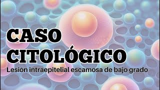 Lesión escamosa de bajo grado en citologia cervicovaginal [upl. by Carmelina]