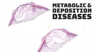 Metabolism amp Deposition Diseases in Skin dermatology dermpath pathology board review [upl. by Llenoj885]