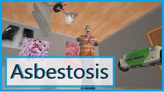 Asbestosis Mnemonic for the USMLE [upl. by Latnahc817]