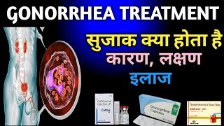 Gonorrhea Treatment  सुजाक का इलाज   how to treat gonorrhea SNPharmacy [upl. by Darrej]