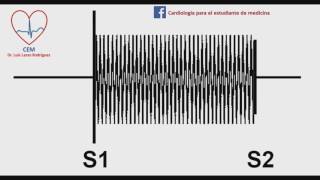 Soplo de la insuficiencia tricuspideamurmur of tricupsid regurgitation [upl. by Ehav]