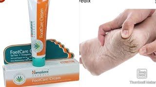 കാലു വിണ്ടു കീറുന്നതിന്Himalaya foot cream benefitscracked feet remedykaalu vindu keeral [upl. by Castor]