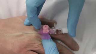 Cannulation How to gain IV access [upl. by Feilak]