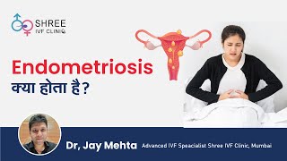 Endometriosis क्या होता है  What Is Endometriosis  Dr Jay Mehta Shree IVF Clinic Mumbai [upl. by Laud]