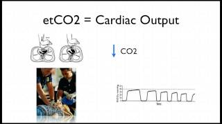 Capnography in Cardiac Arrest [upl. by Aneeuqahs]