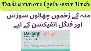 Daktarin oral gel uses  how to use daktarin oral gel  miconazole [upl. by Suiramaj]