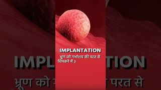 What is IMPLANTATION implantation [upl. by Dotti]