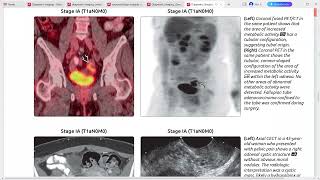 GYNAE IMAGING DIAGNOSTIC IMAGING SERIES [upl. by Roman]