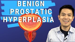 Basics of Enlarged Prostate Treatments  Benign Prostatic Hyperplasia [upl. by Eiddet177]