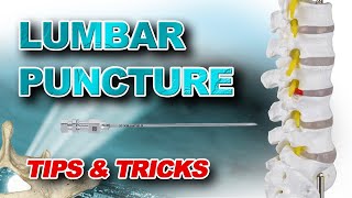 Lumbar Puncture Tips amp Tricks [upl. by Bertrand292]