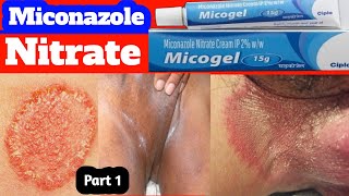 Fungal infection in private parts 🔥 jock itch treatment 💥 tinea cruris treatment 🔥 part1 [upl. by Sauveur]