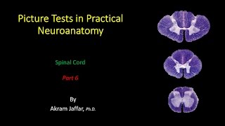 Picture Test in Neuroanatomy Spinal Cord 6 [upl. by Hokanson]