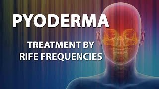 Pyoderma  RIFE Frequencies Treatment  Energy amp Quantum Medicine with Bioresonance [upl. by Wohlert]