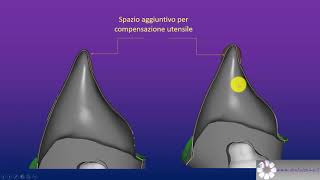 Tutorial ITA per Exocad Step 1 [upl. by Aidan]