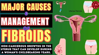 Uterine Fibroids Causes Signs and Symptoms Diagnosis and Treatment  Home Treatment for Fibroid [upl. by Brendon640]