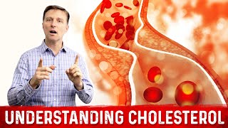 How to Read and Understand Your Cholesterol Levels [upl. by Cortie40]