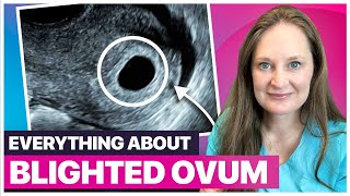 Blighted Ovum Explained Causes Diagnosis and What to Do Next [upl. by Ahseka199]