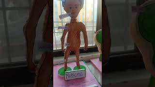 Kwashiorkor and marasmus model project [upl. by Eatnoid422]