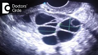 What do follicle size change in follicular study scan signify  Dr Teena S Thomas [upl. by Aryek834]