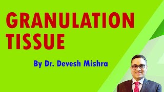 Granulation tissue by Dr Devesh Mishra [upl. by Deroo171]