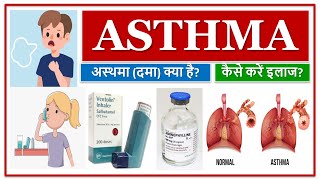 ASTHMA  MEDICINES  अस्थमा दमा क्या है कैसे करें इलाज MEDICINE USE TO TREAT ASTHMA [upl. by Nirrek417]