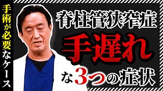 脊柱管狭窄症、後悔・手遅れにならないために知るべき症状や原因、手術かリハビリか？椎間板ヘルニア、分離症すべり症 [upl. by German]