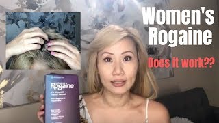 TRUTH ABOUT WOMENS ROGAINE DOES IT WORK [upl. by Graner]