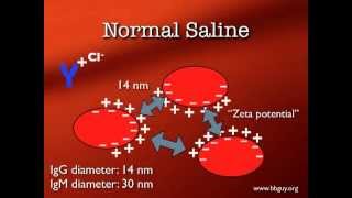 Pretransfusion Testing [upl. by Ecarg]