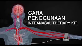 Cara Penggunaan Intranasal Therapy Kit [upl. by Airdnas]