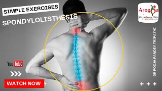 Anterolisthesis spondylolisthesis L5s1 spondylolisthesis Treatment Exercise Low back pain [upl. by Pacorro]