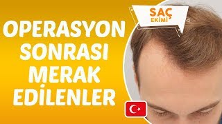 Saç Ekimi Operasyonu Sonrası Dikkat Edilmesi Gerekenler Nelerdir  Dr Hamid AYDIN [upl. by Dalton26]