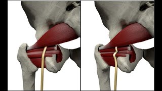 Sciatic Nerve Dynamic Ultrasound  Includes Obturator Gemellus Piriformis Quadratus Femoris [upl. by Hanid417]