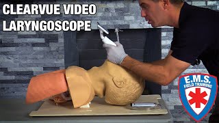 ClearVue Video Laryngoscope Overview [upl. by Roderich]