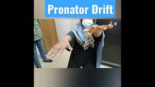 Pronator Drift a subtle motor weakness indicating Stroke  Shorts [upl. by Akenahs]