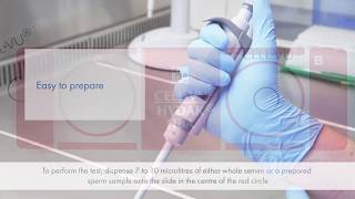 HBA SpermHyaluronan Binding Assay [upl. by Stempson855]