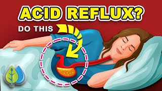 3 Ways to Stop ACID REFLUX Naturally  How to Stop Acid Reflux amp HEARTBURN [upl. by Aivilys280]