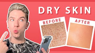 Your Dry Skin Questions ANSWERED [upl. by Ynahpets710]