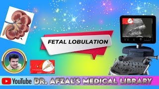 fetal lobulation of kidneys [upl. by Ennagroeg]