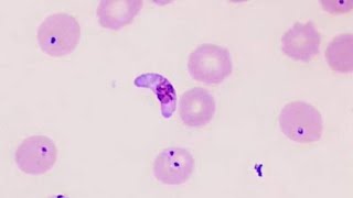 Plasmodium vivax y Plasmodium falciparum con Giemsa [upl. by Neyut]