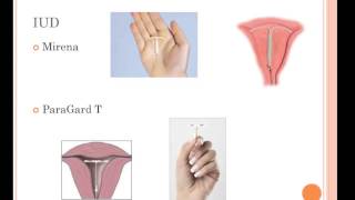 Contraceptive Methods [upl. by Andaira]