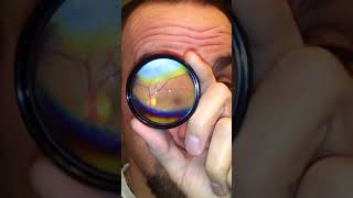 How to Do Your Own Fundus Exam [upl. by Esela454]