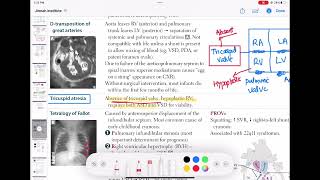 Tricuspid Atresia congenitalheartdisease cardiology 55 First Aid USMLE Step 1 in UrduHindi [upl. by Nolrak510]