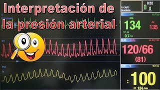 Interpretación de la presión arterial [upl. by Perkins]