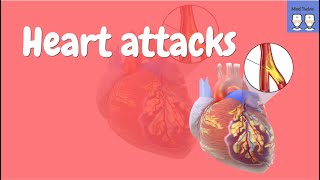 What is a heart attack Pathophysiology STEMI NSTEMI ECG interpretation Diagnosis Symptoms [upl. by Thebazile]