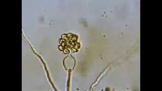 Release of Zoospores by Pythium [upl. by Gregorius301]